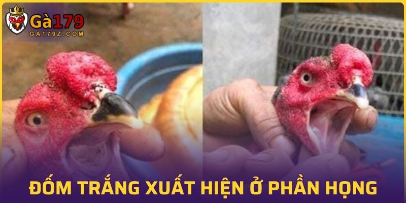Đốm trắng xuất hiện ở phần họng